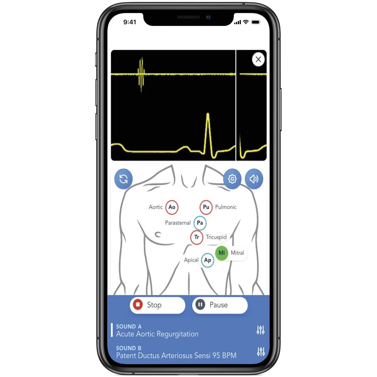 SAM4 Plus Auscultation Manikin, Dark